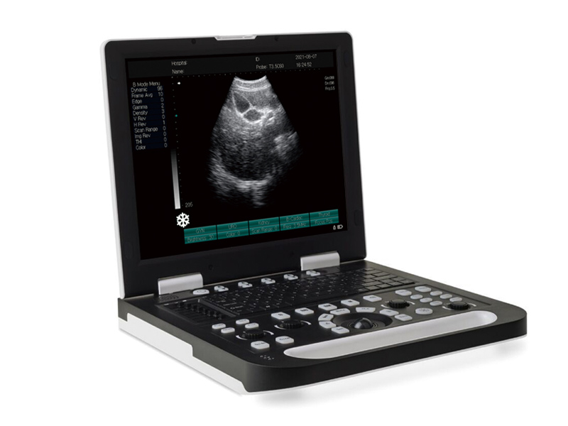 SS-10 instrumento de diagnóstico ultrasónico portátil totalmente digital