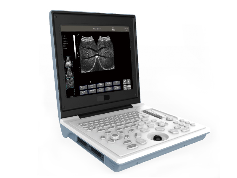 SS-6B Instrumento de diagnóstico por ultrasonido digital completo del cuaderno