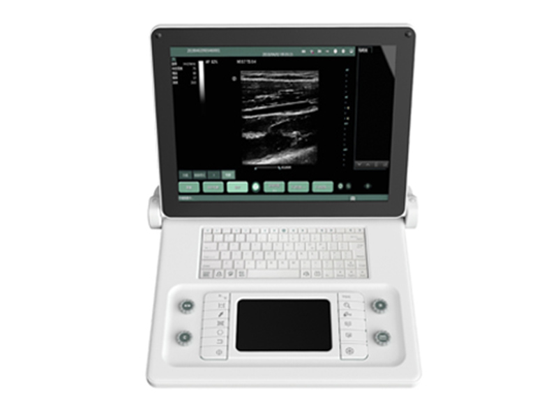 SS-8B Sistema de diagnóstico por ultrasonido digital completo