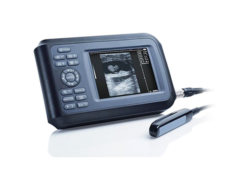 V7 Sistema de diagnóstico por ultrasonido digital completo de mano