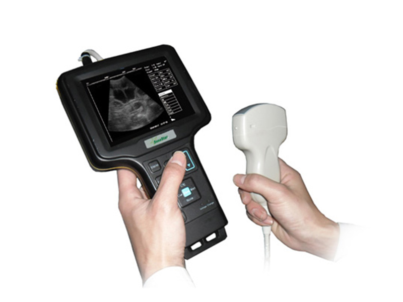 V6 Diagnóstico por ultrasonido de palma (diagnóstico por ultrasonido en modo B en blanco y negro)