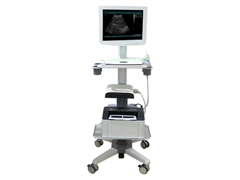 SS-100 Instrumento de diagnóstico de imagen ultrasónica tipo carro de pantalla táctil