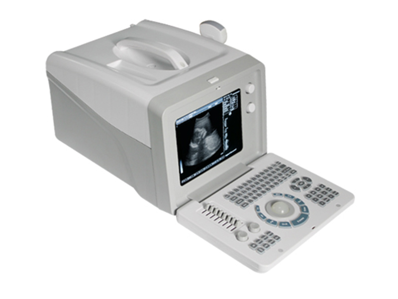 SS-5 Diagnóstico por ultrasonido (diagnóstico por ultrasonido en color en modo B en blanco y negro)