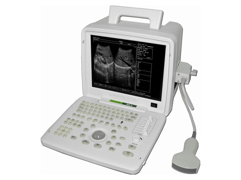 SS-6 Instrumento de diagnóstico de ultrasonido digital (ultrasonido en modo b)