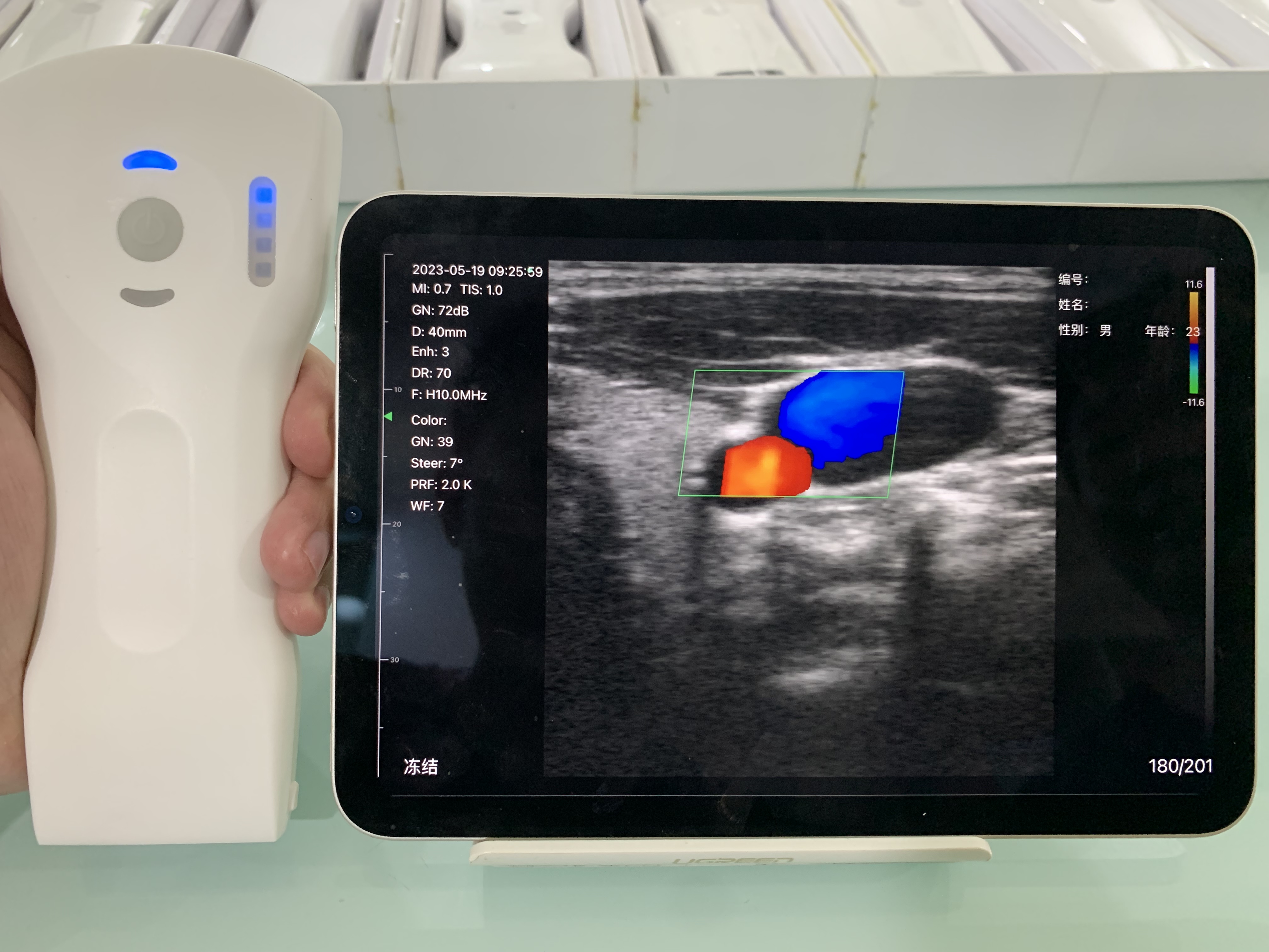 8CPL 3in1 ultrasonido Doppler Palmar