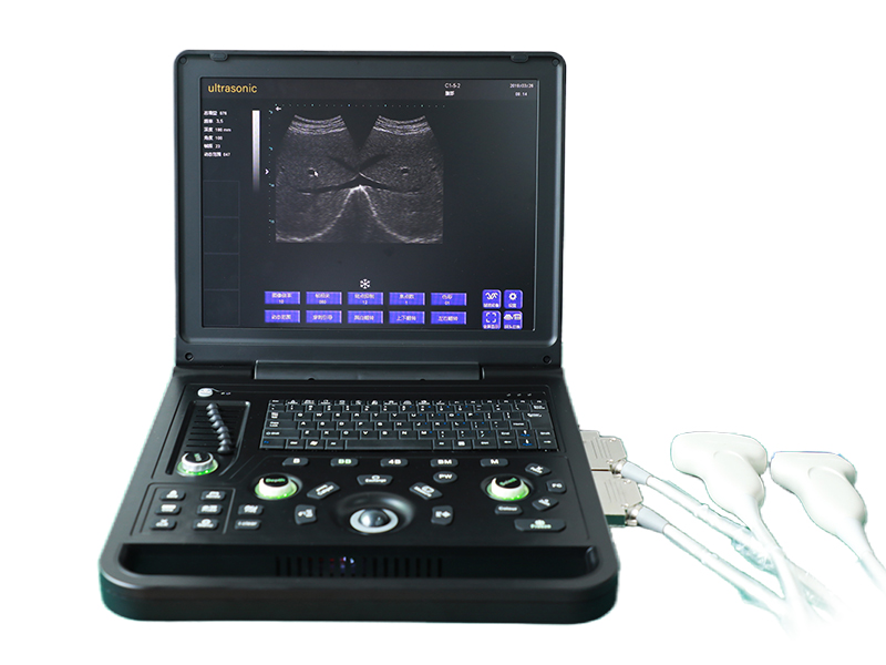 SS-7C 笔记本全数字超声诊断仪