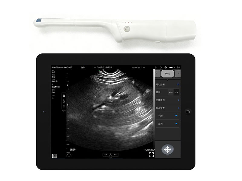 8CR直肠T型双平面无线探头式掌上彩超