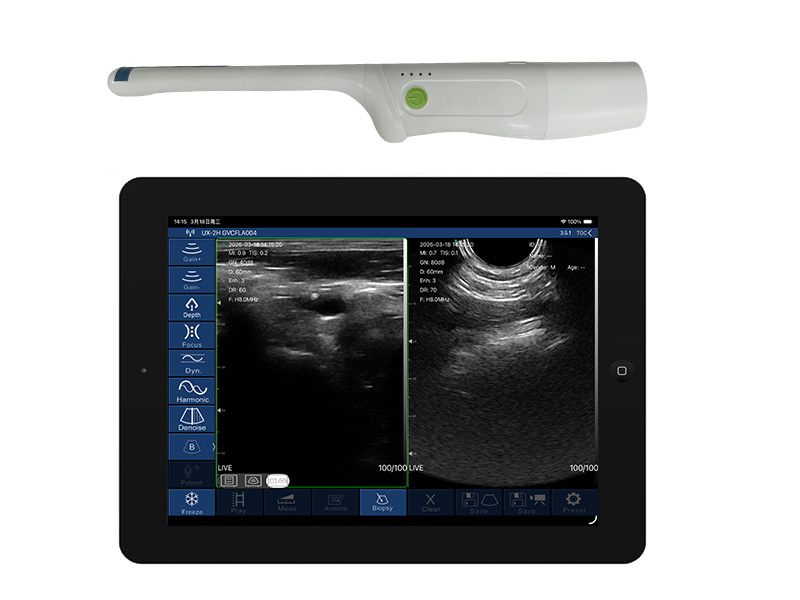 8CR直肠T型双平面无线探头式掌上彩超