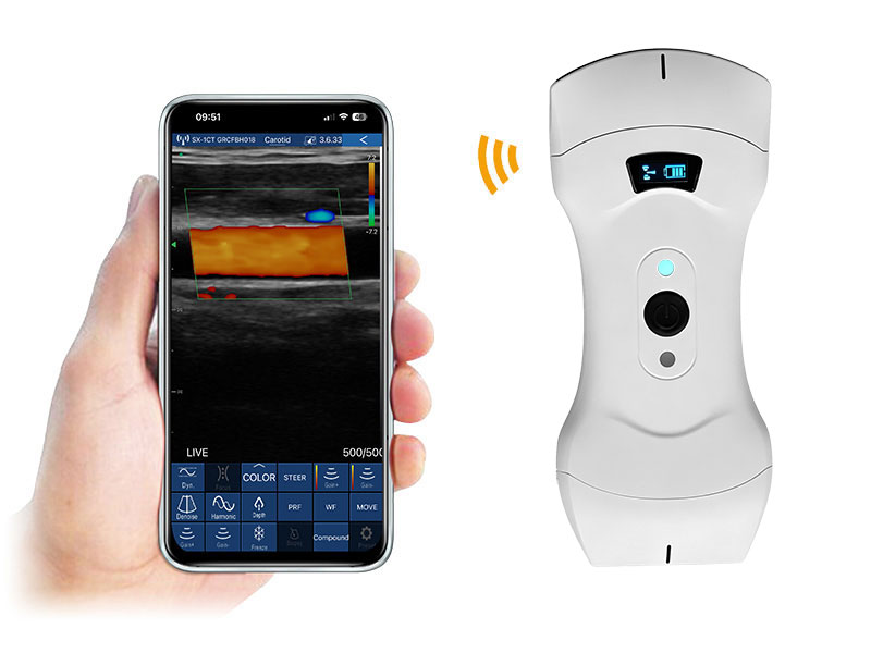 6CPL Plus 3in1 escáner de ultrasonido doppler de la palma