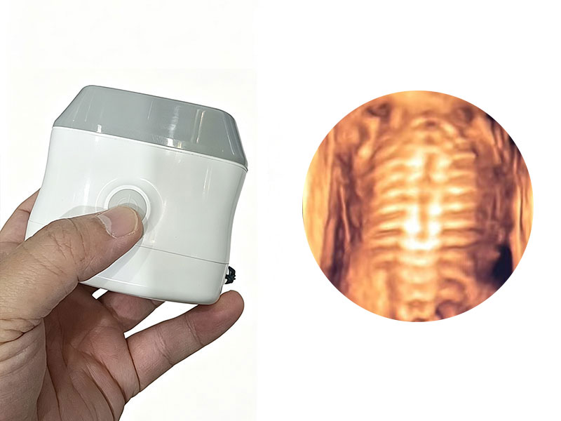 Ultrasonido de imagen 3D de matriz lineal portátil 4D