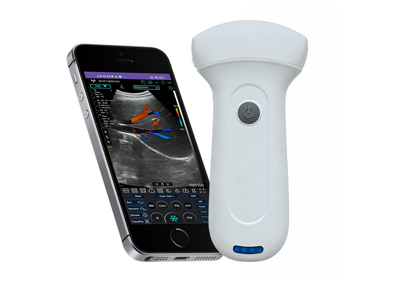 7C Escáner de ultrasonido Doppler de palma convexa