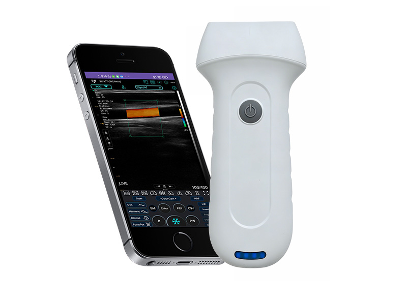 7L Escáner de ultrasonido Doppler lineal de la palma