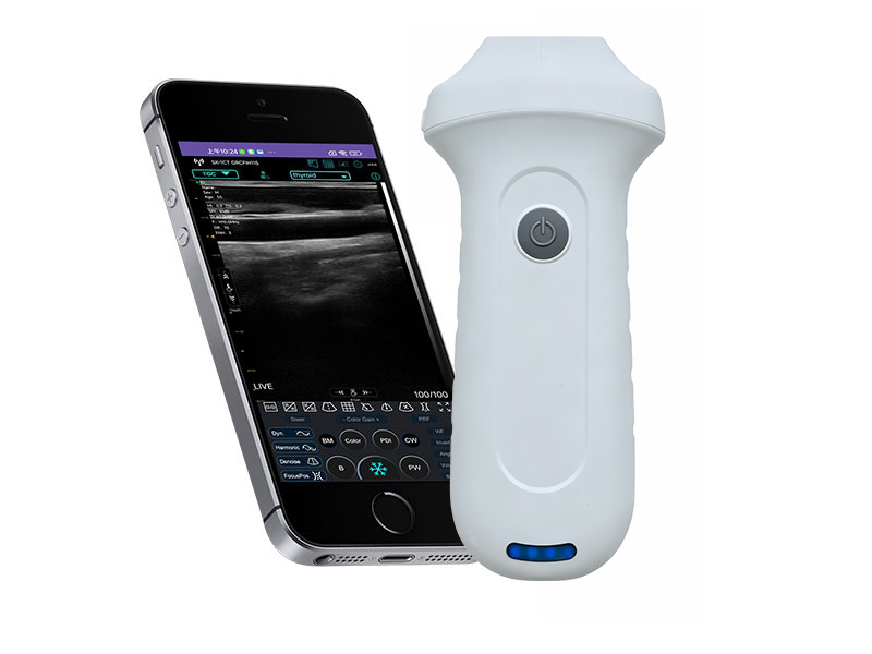 7N Escáner de ultrasonido Doppler lineal de la palma