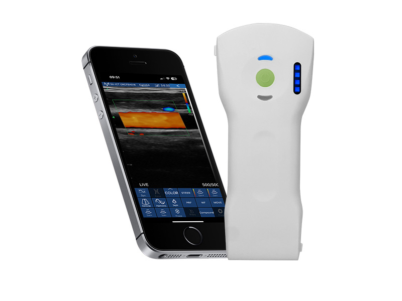 7CPL 3in1 (exclusivo VIP) Escáner de ultrasonido doppler de la palma de la mano