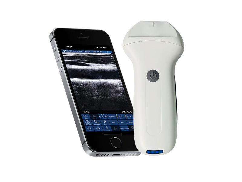 8N Escáner de ultrasonido Doppler lineal de la palma