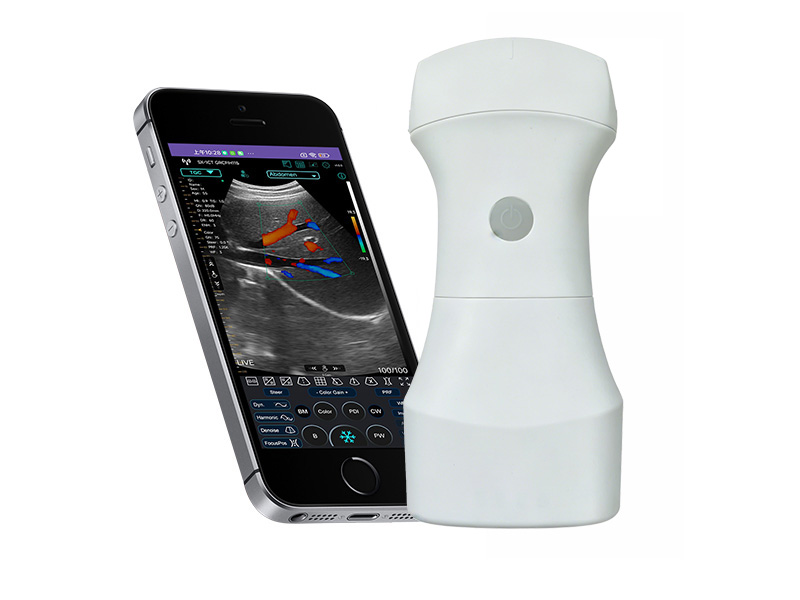 9C Ultrasonido Doppler de la palma convexa de la batería reemplazable