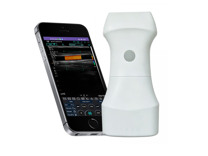 9L (exclusivo VIP) Escáner de ultrasonido Doppler lineal de la palma de la batería reemplazable