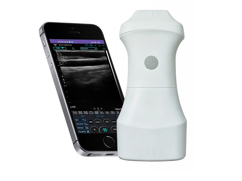 9N Ultrasonido Doppler lineal de la palma de la batería reemplazable