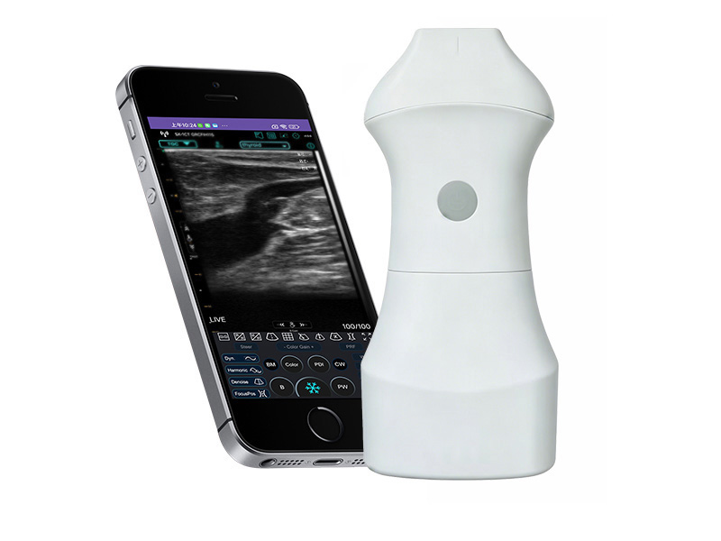 9H Ultrasonido Doppler lineal de la palma de la batería reemplazable
