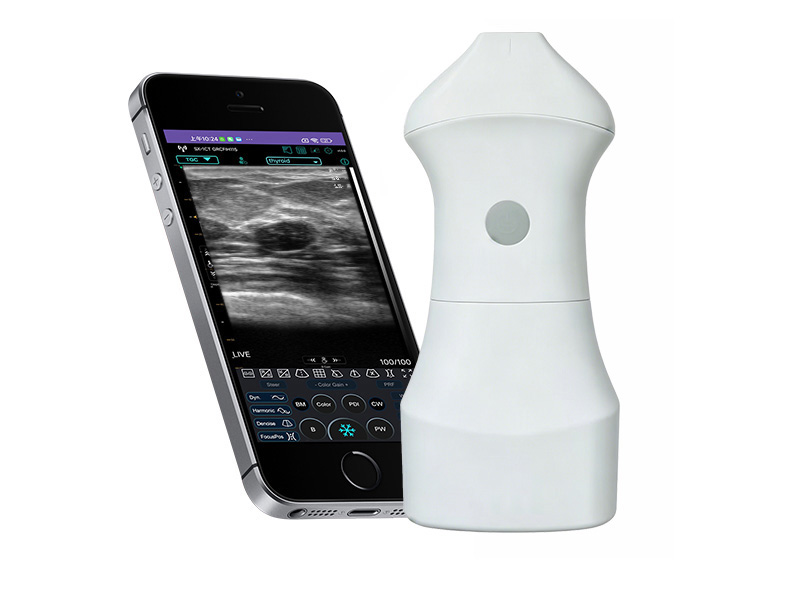 9S Ultrasonido Doppler lineal de la palma de la batería reemplazable