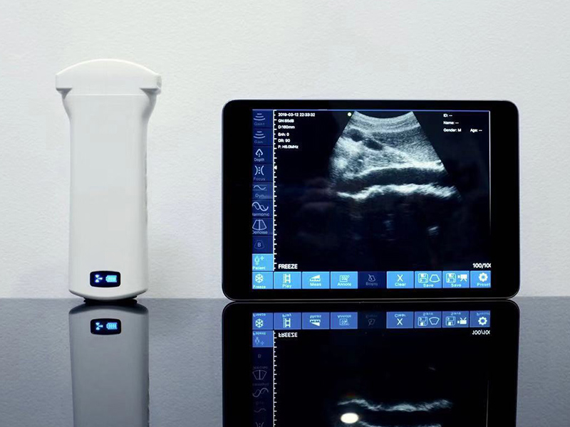 Clinical Procurement Guide for Sonostar Portable Ultrasound Diagnostic Devices