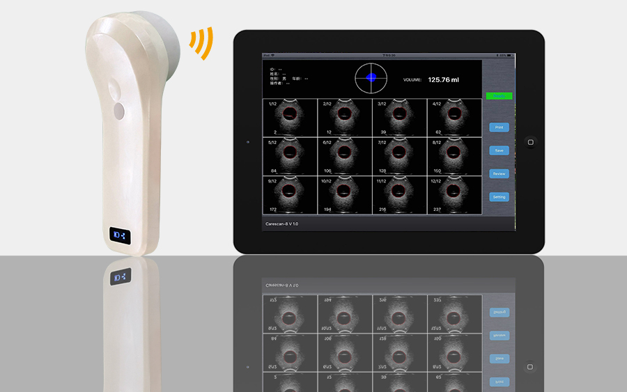 Wireless Bladder Scanner Technology: How 4D Array Scanning Improves Bladder Volume Measurement Accur